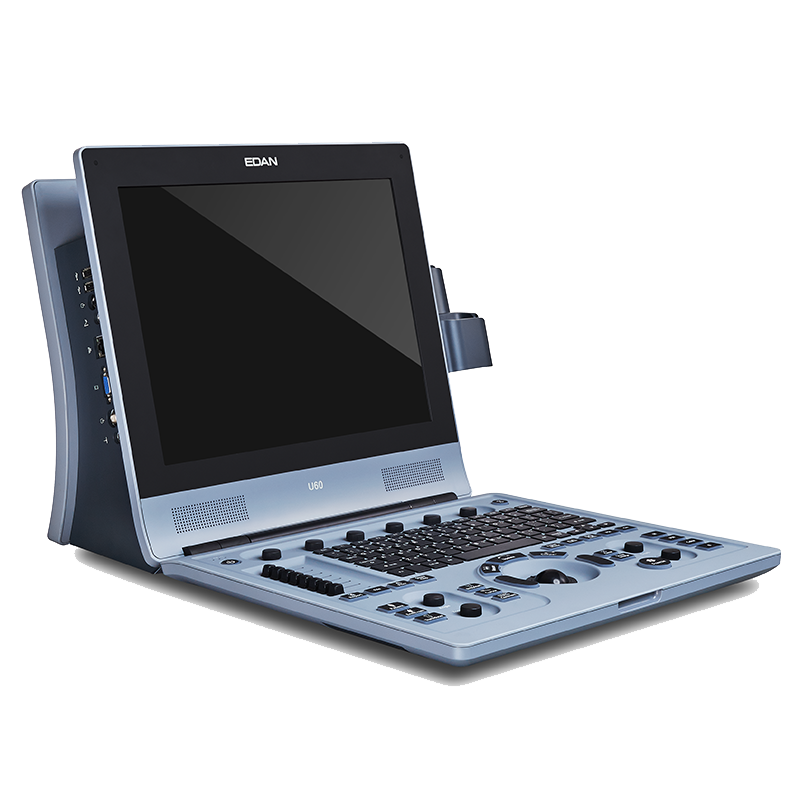 Edan U60 - изображение №3