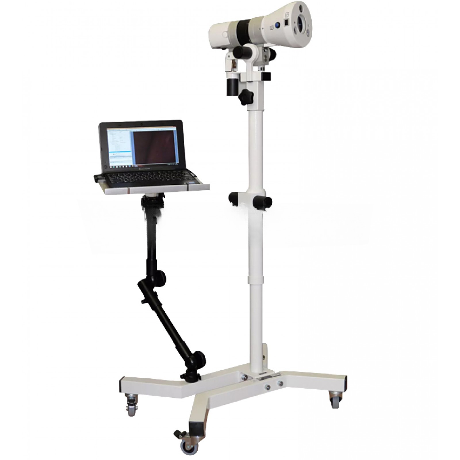 Оптимед ВКС-01 модель 055-10