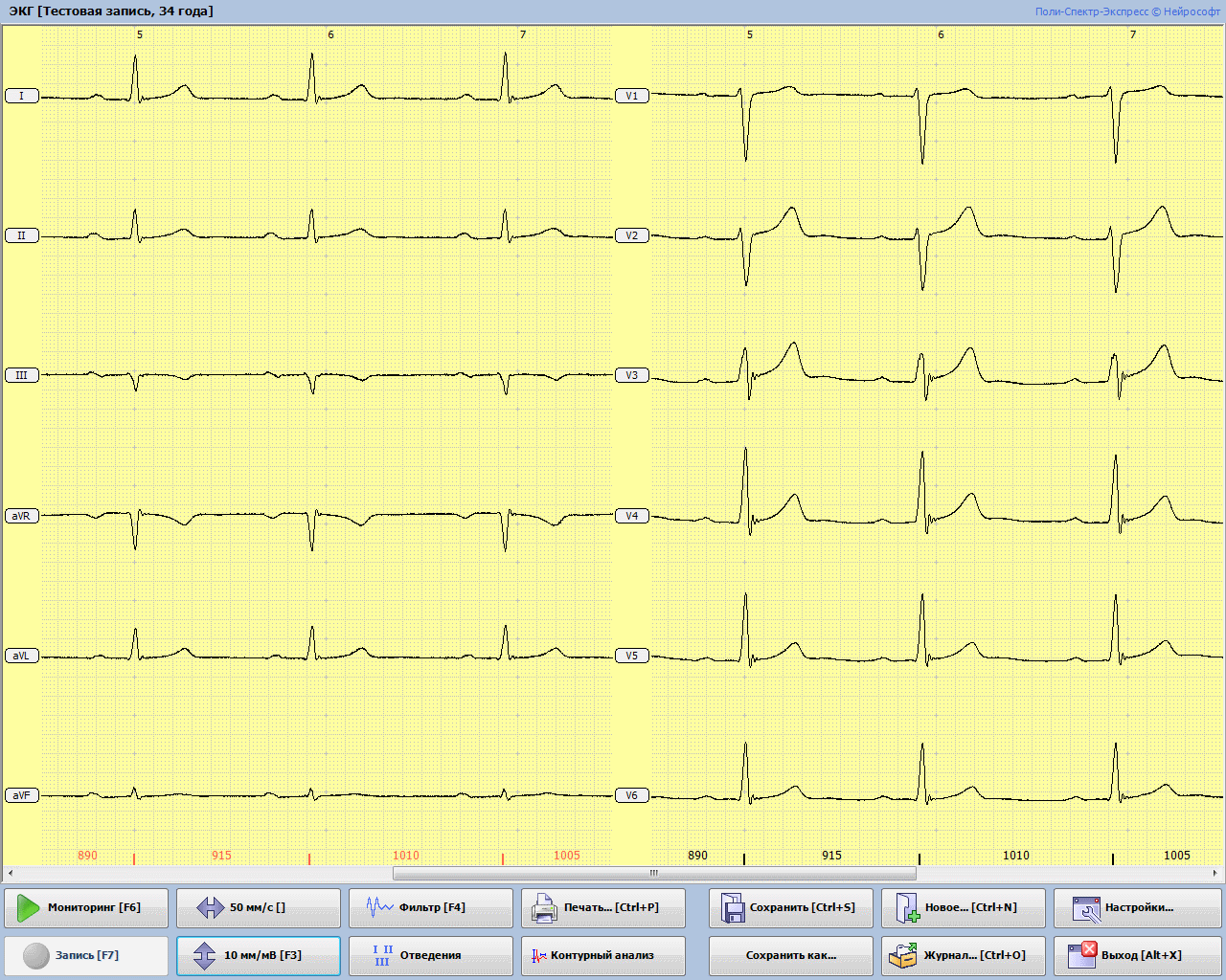ПОЛИ-СПЕКТР-8/EX - изображение №2
