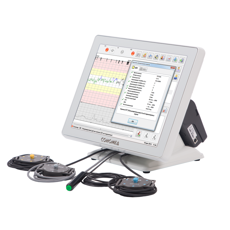 СОНОМЕД 200 - изображение №3