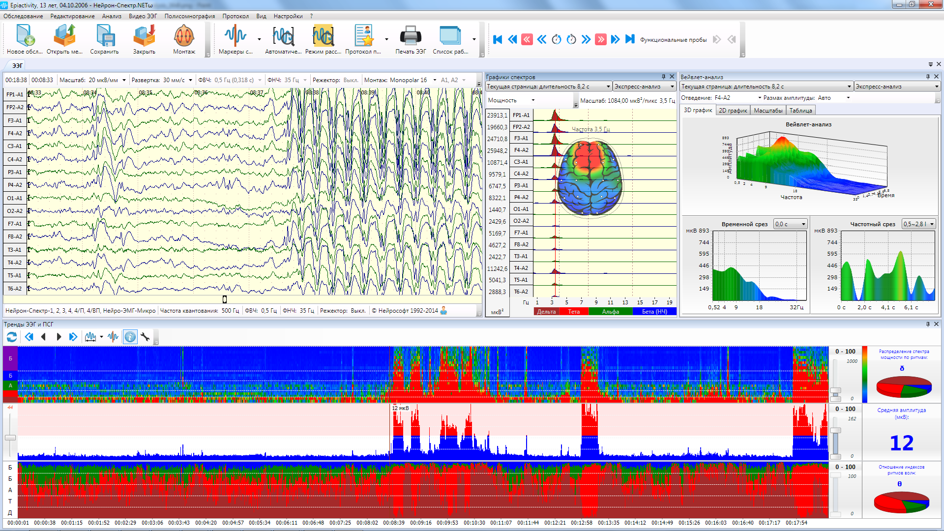 НЕЙРОН-СПЕКТР-4 - изображение №11