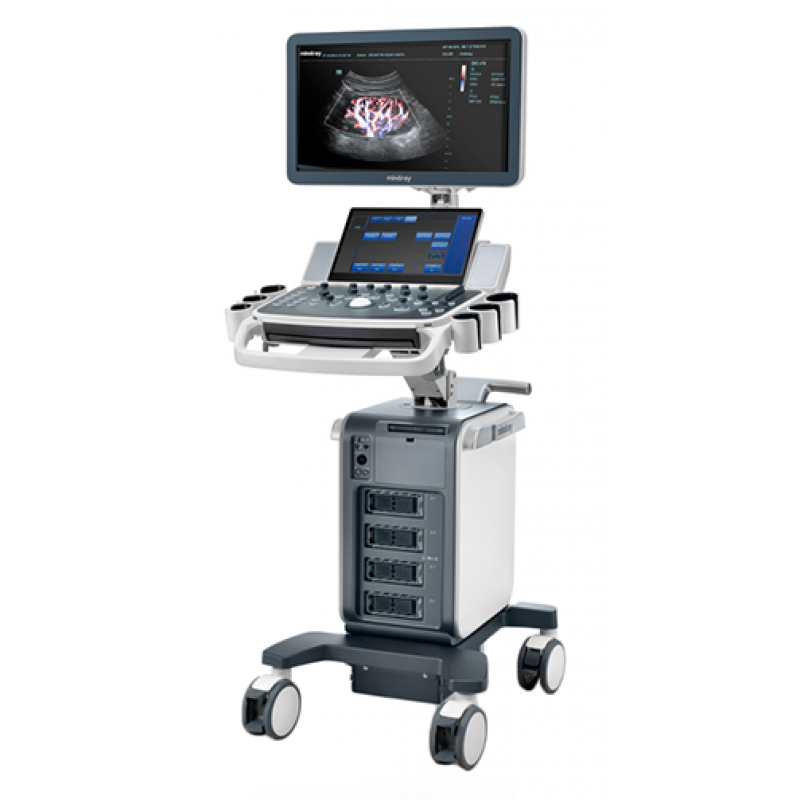 Mindray DC-70 Pro X-Insight - изображение №2