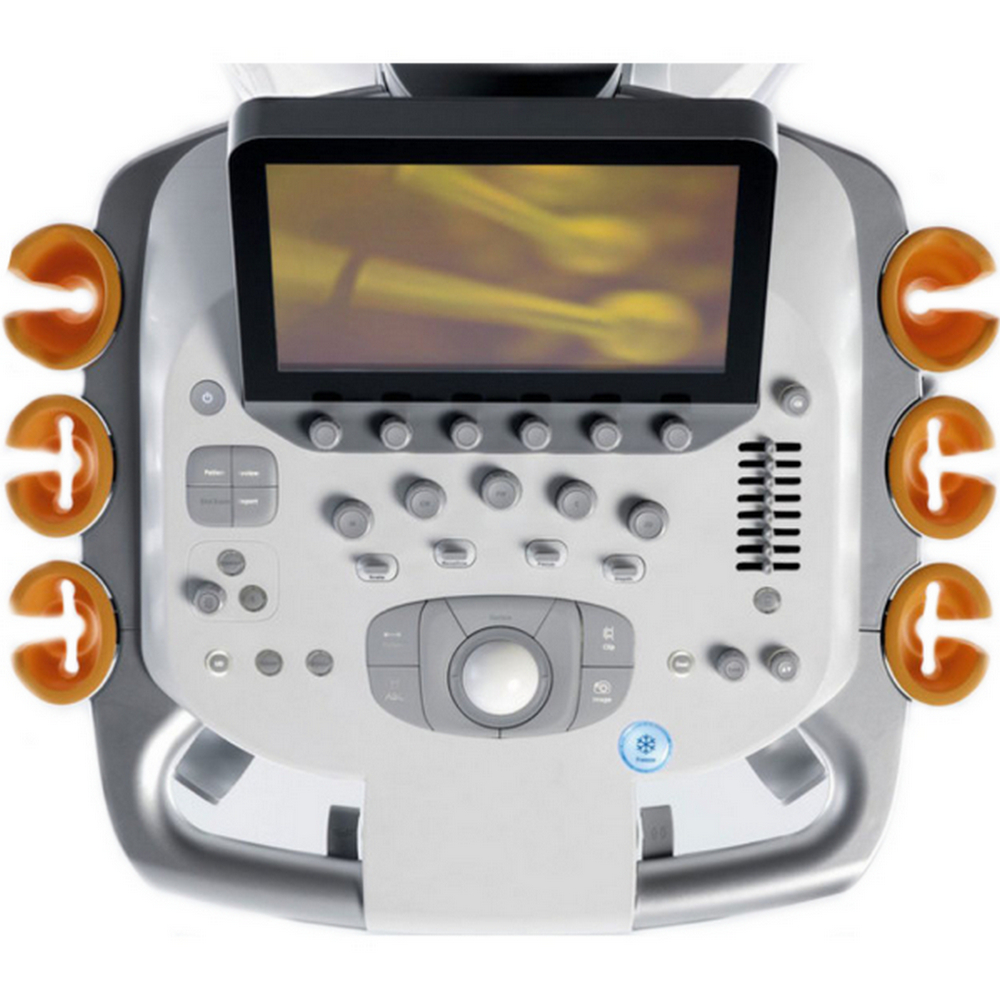 Siemens ACUSON S3000 - изображение №5