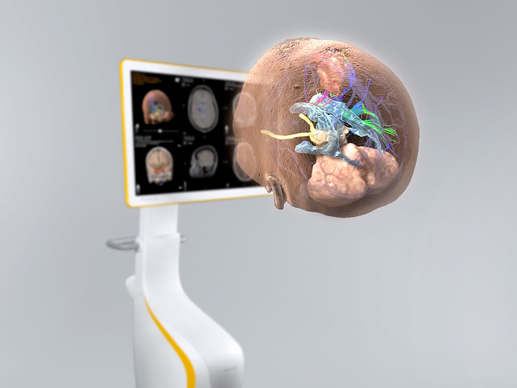 Brainlab Curve Navigation - изображение №6