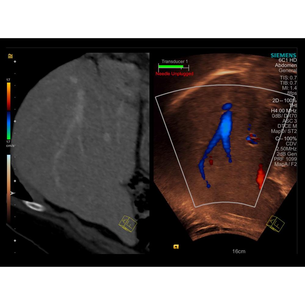Siemens ACUSON S3000 - изображение №9