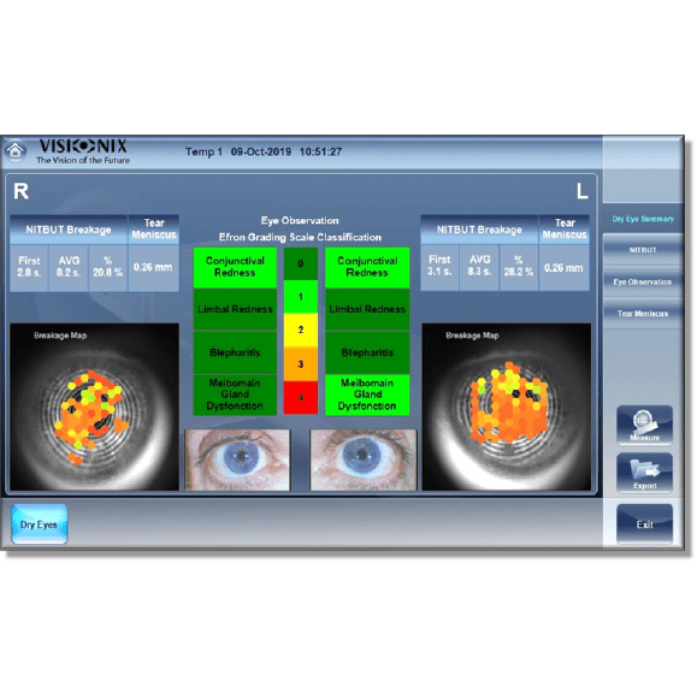 Visionix VX120+ DRY EYE - изображение №2