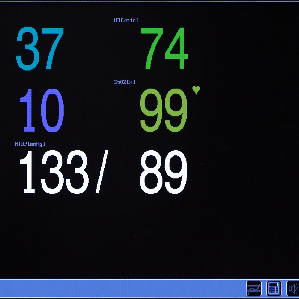 МПР6-03 Комплектация Р2.21 - изображение №3