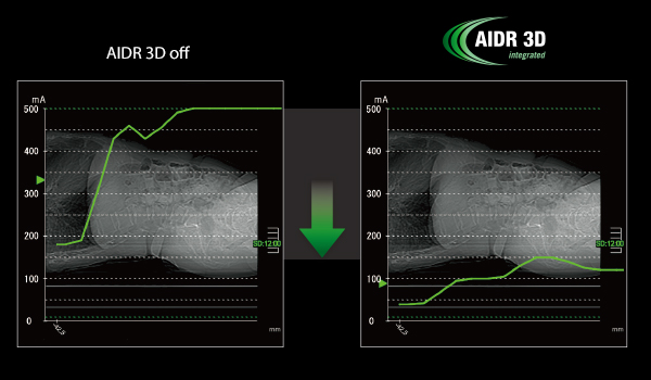 Комплексное снижение дозы.jpg