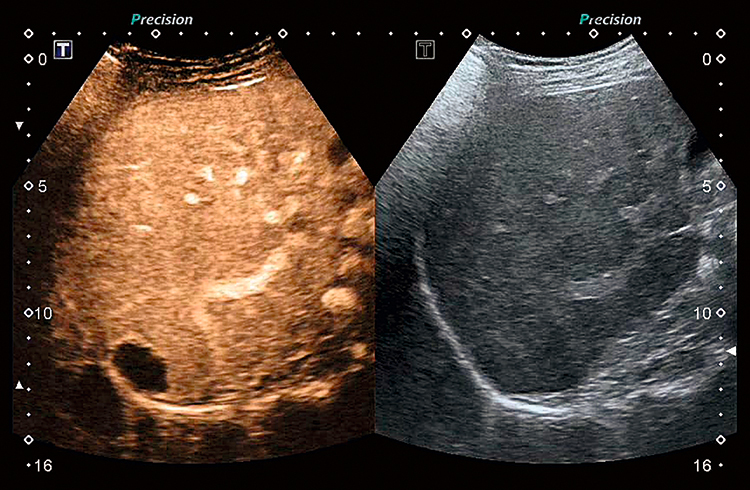 Полный пакет визуализации Aplio.jpg