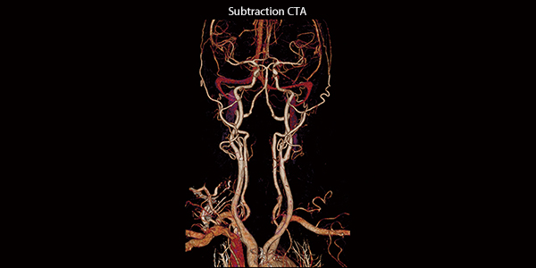 Вычитание СТА.jpg