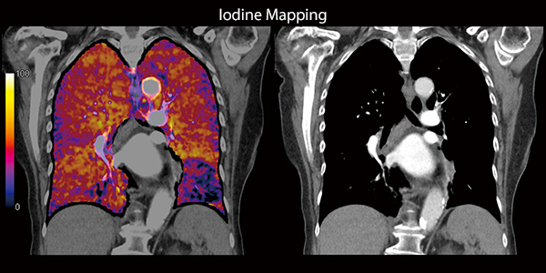Йодное картирование.jpg
