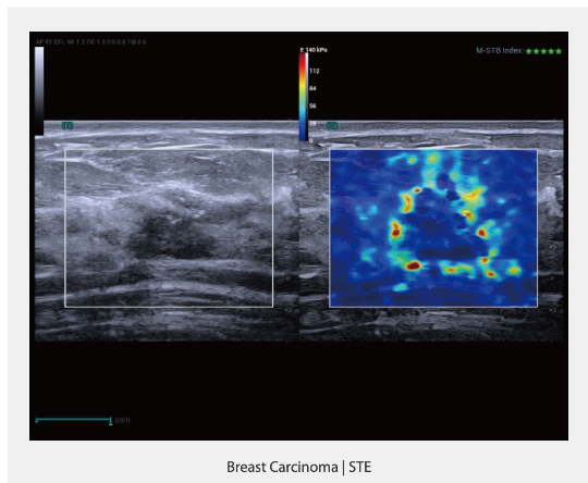 Снимок экрана 2024-11-18 164637.png