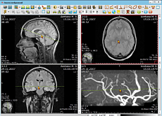 PACS/RIS АПК АрхиМед