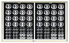 Негатоскоп.Ру двухкадровый