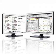 Мицар-ЭЭГ-ВП