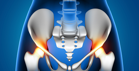 В Новосибирске научились синтезировать порошок для производства медицинской керамики