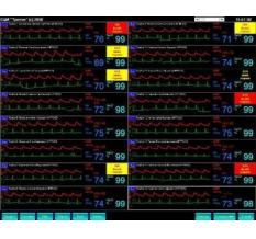 Мониторы пациента СЦМ1.21
