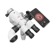 Гинекологические кольпоскопы MEDPRIBOR с адаптером для смартфона