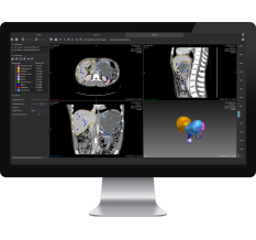Рентгенология Autoplan (РУ 2019/8153)