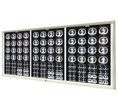 Рентгенология Негатоскоп.Ру трехкадровый