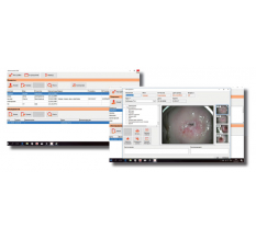 Гинекологические кольпоскопы ПО КС-01