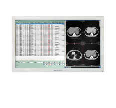 Мониторы пациента HL2416SHT