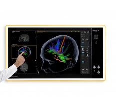 Системы навигации Brainlab BUZZ Digital O.R.