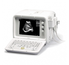 УЗИ аппараты Edan DUS 3