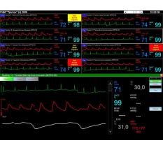 Мониторы пациента СЦМ2.21