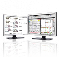  Мицар-ЭЭГ-ВП